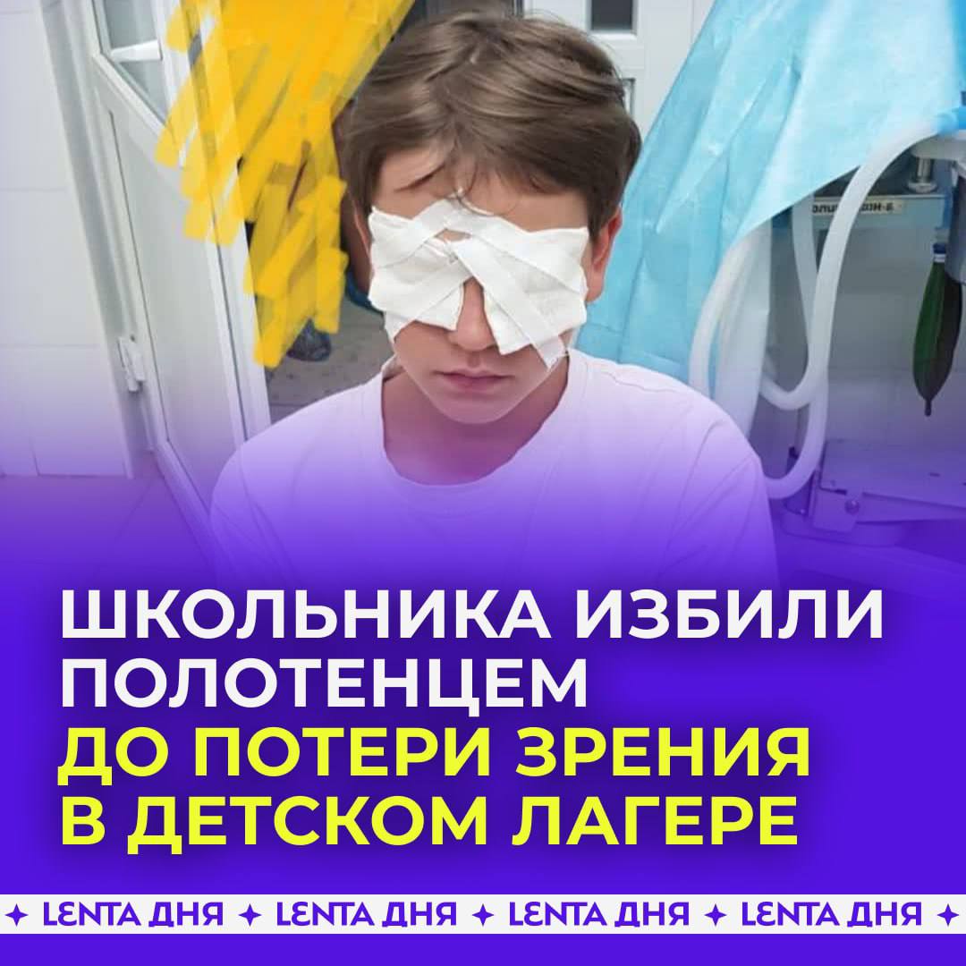 😱 Школьника <b>избили</b> полотенцем до <b>потери</b> <b>зрения</b> в детском лагере. 