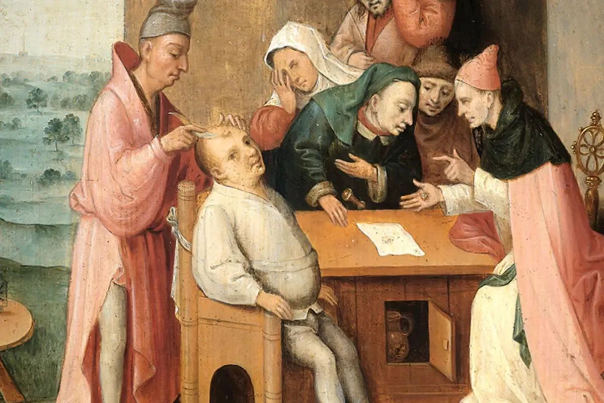 Врач 17 век. Врачевание в средние века. Трепанация черепа в средневековье. Хирургия в средневековье.
