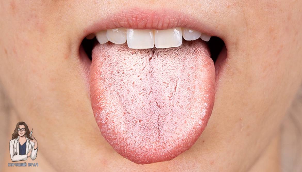 Estómago sucio lengua blanca