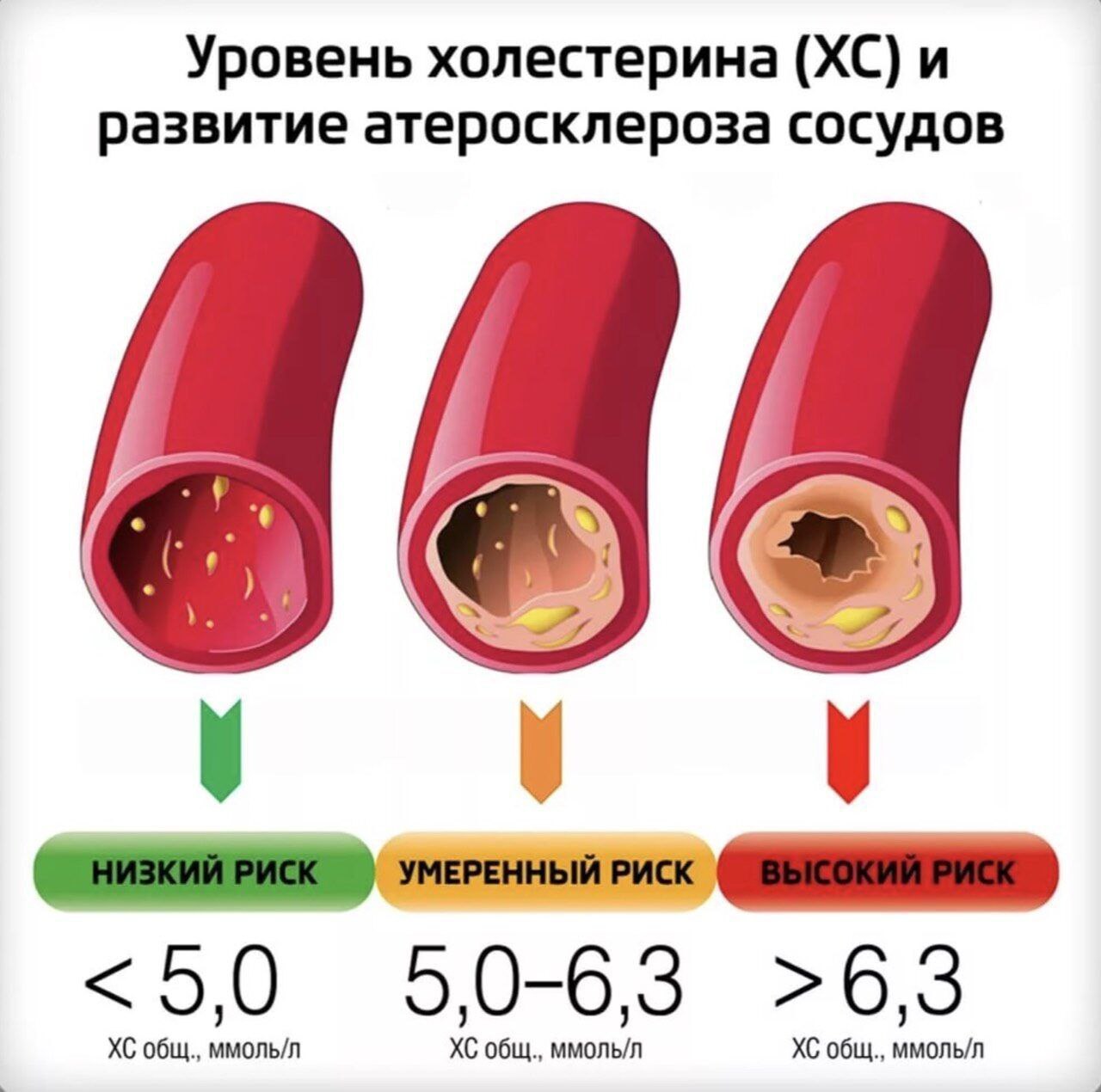 повышенный холестерин стол 10